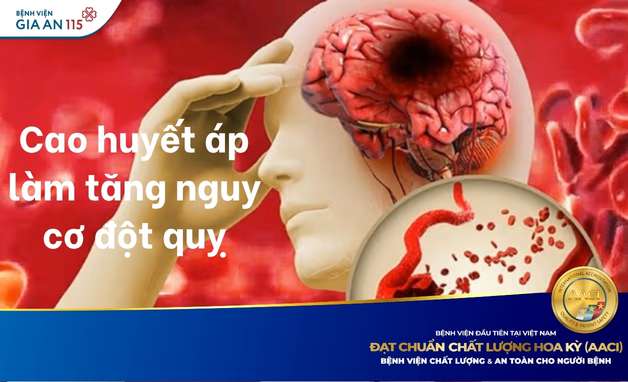 Cao huyết áp và nguy cơ đột quỵ: Đừng chủ quan với “kẻ giết người thầm lặng”