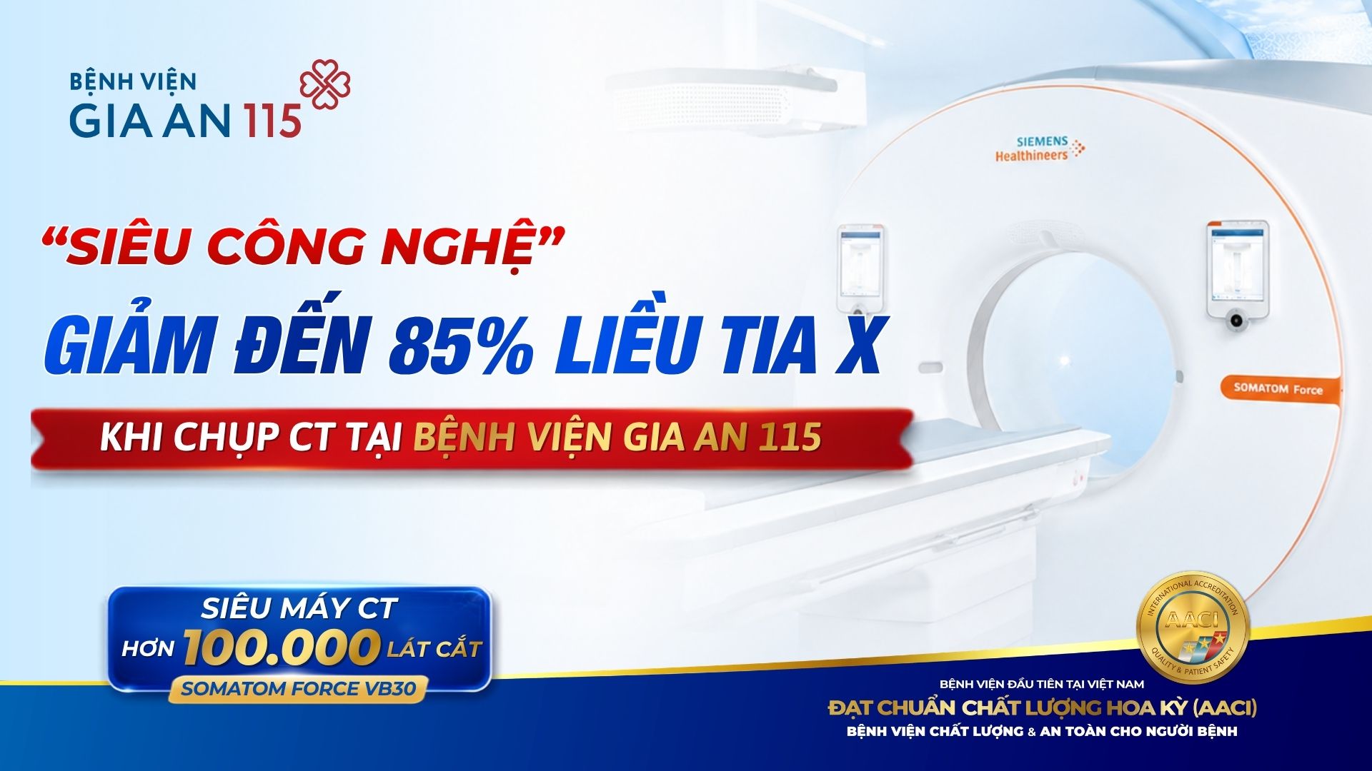 “SIÊU CÔNG NGHỆ” GIẢM ĐẾN 85% LIỀU TIA X KHI CHỤP CT TẠI BỆNH VIỆN GIA AN 115